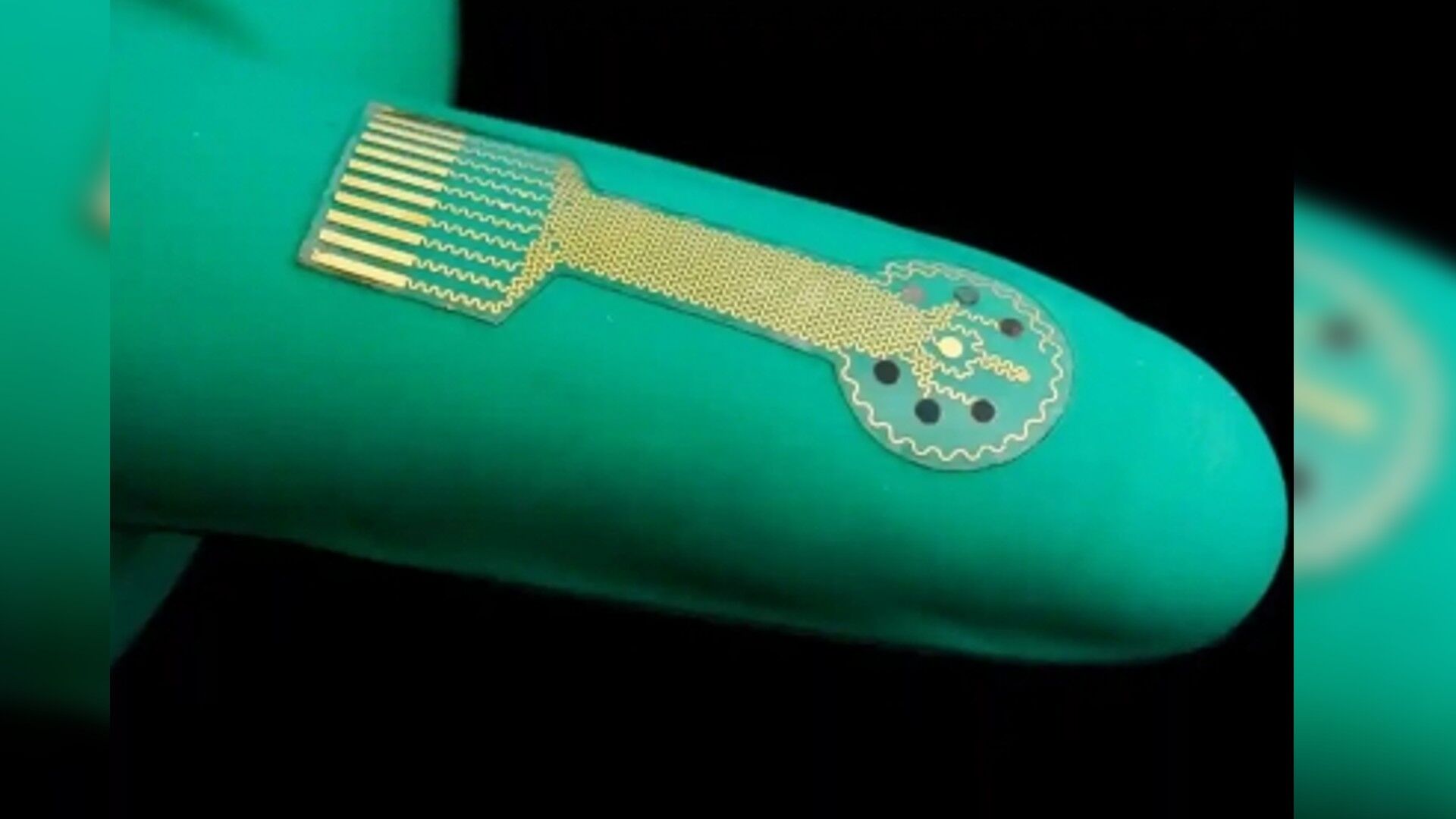 New ‘smart’ bandages to help heal chronic diabetic wounds